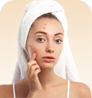 Mild Acne treatment